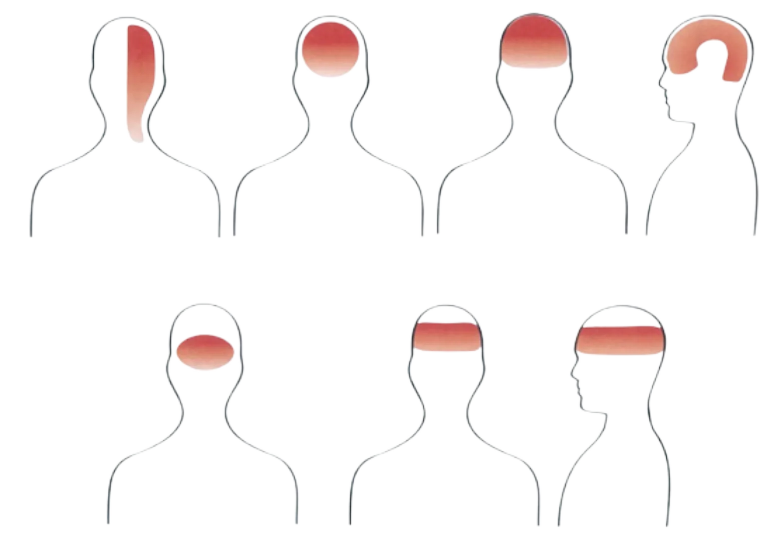 Headaches diagram